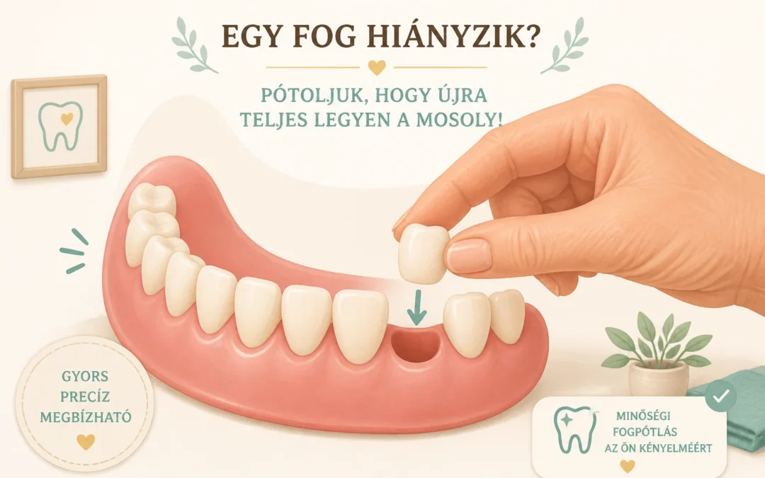 Kiesett fog a fogsorból – hogyan pótolják?